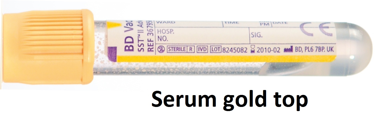 Tissue transglutaminase (TTG) | University Hospitals of North Midlands